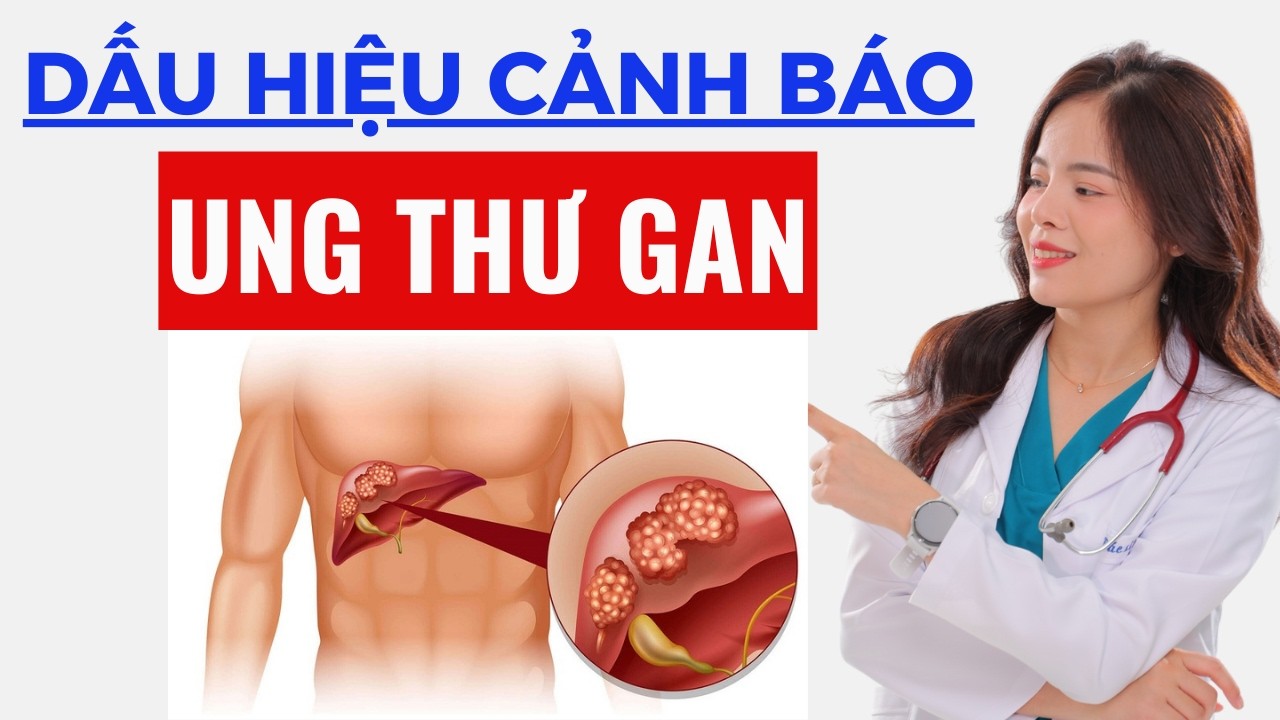 5 Biểu Hiện Của Bệnh UNG THƯ GAN Ai Cũng Cần Biế | Dr Thùy Dung