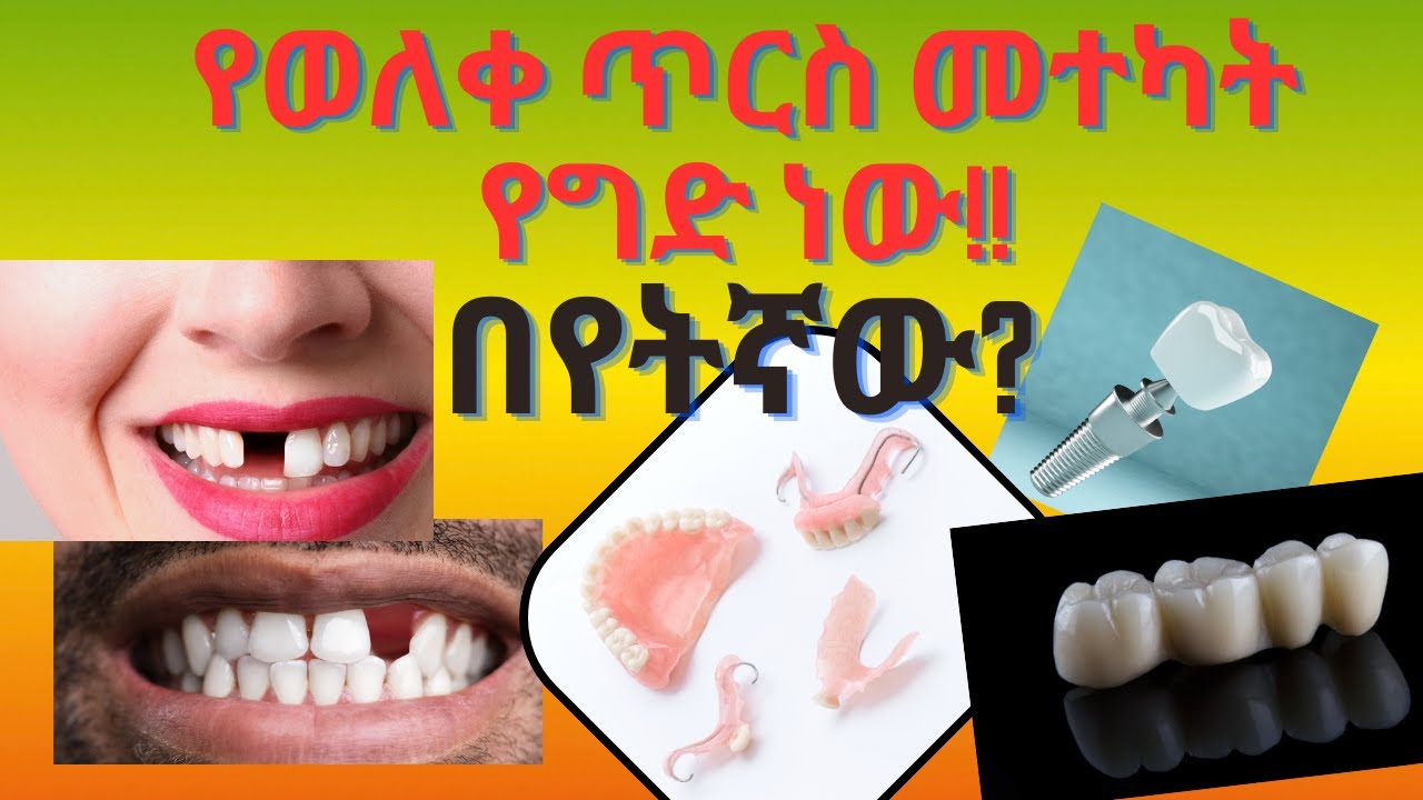 የጎደሉትን ጥርሶች በአርቲፊሻል ጥርሶች መተካት ጥቅሙ