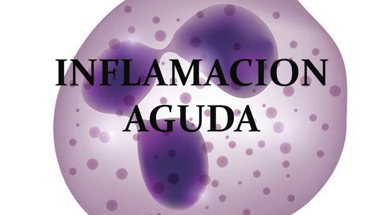 Inflamaci&oacute;n aguda