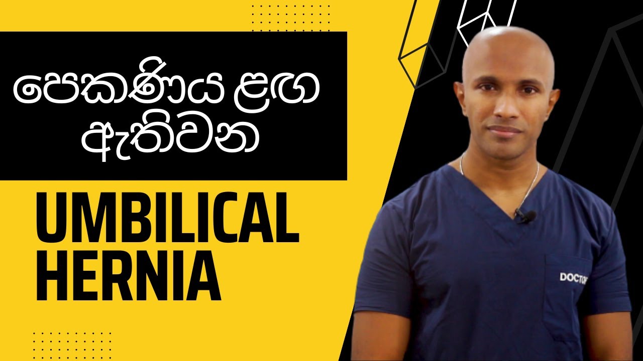 පෙකණිය ළඟ ඇතිවන umbilical hernia - මහාචාර්ය  දක්ෂිත වික්‍රමසිංහ