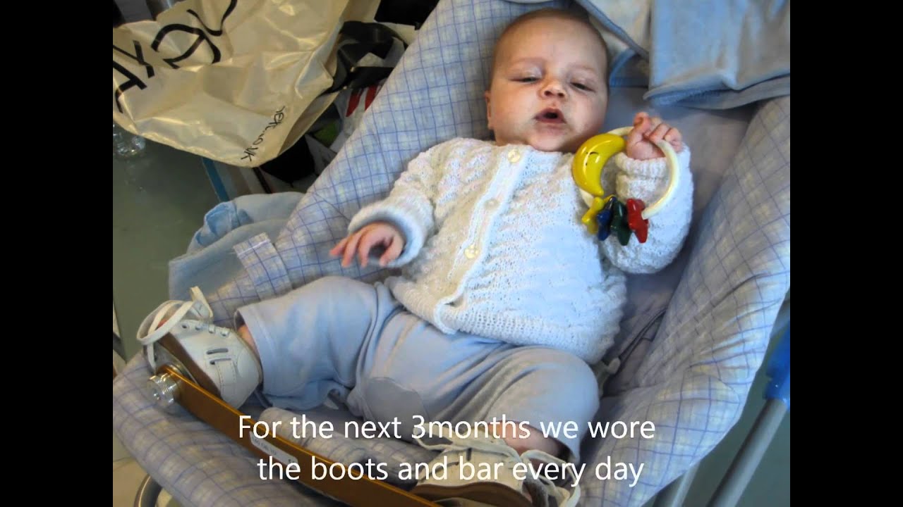 Our Talipes Story - Daniel de Kock