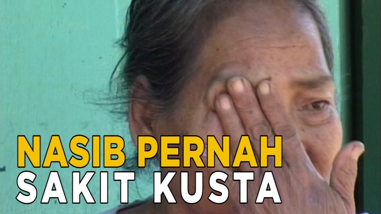Nasib pilu karena pernah mengidap penyakit kusta | KEJAMNYA DUNIA