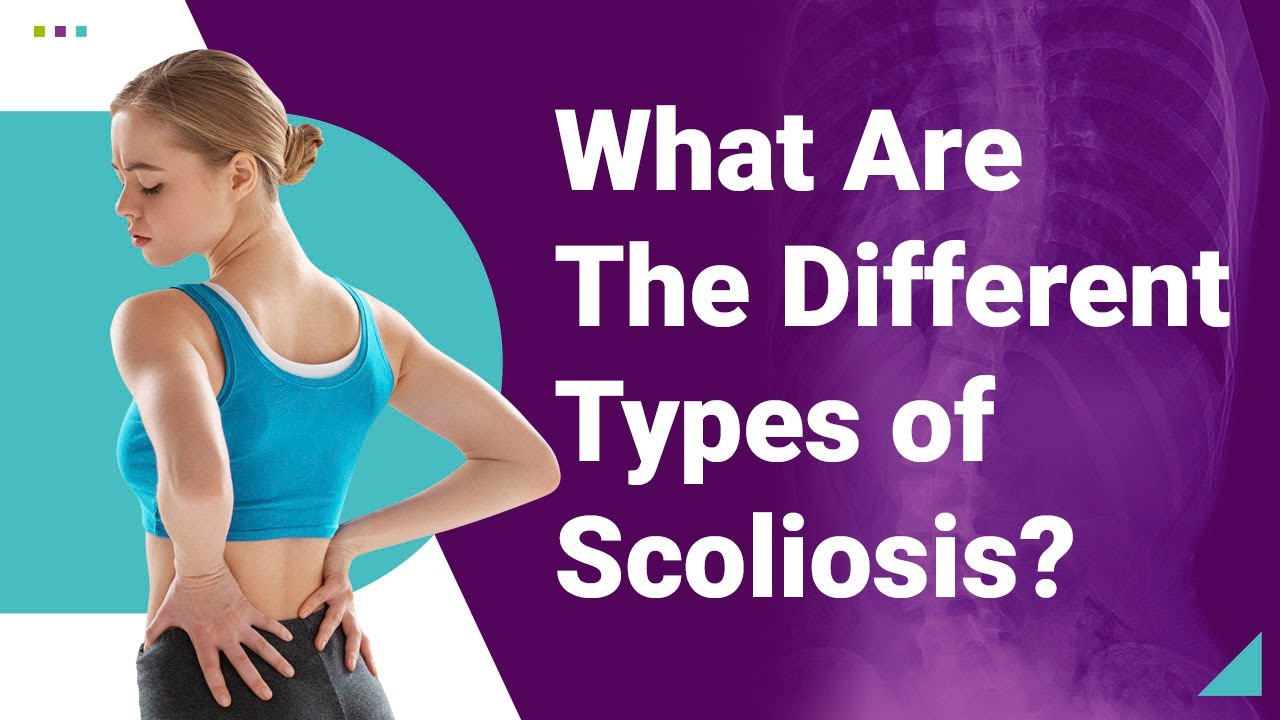 What Are The Different Types of Scoliosis?