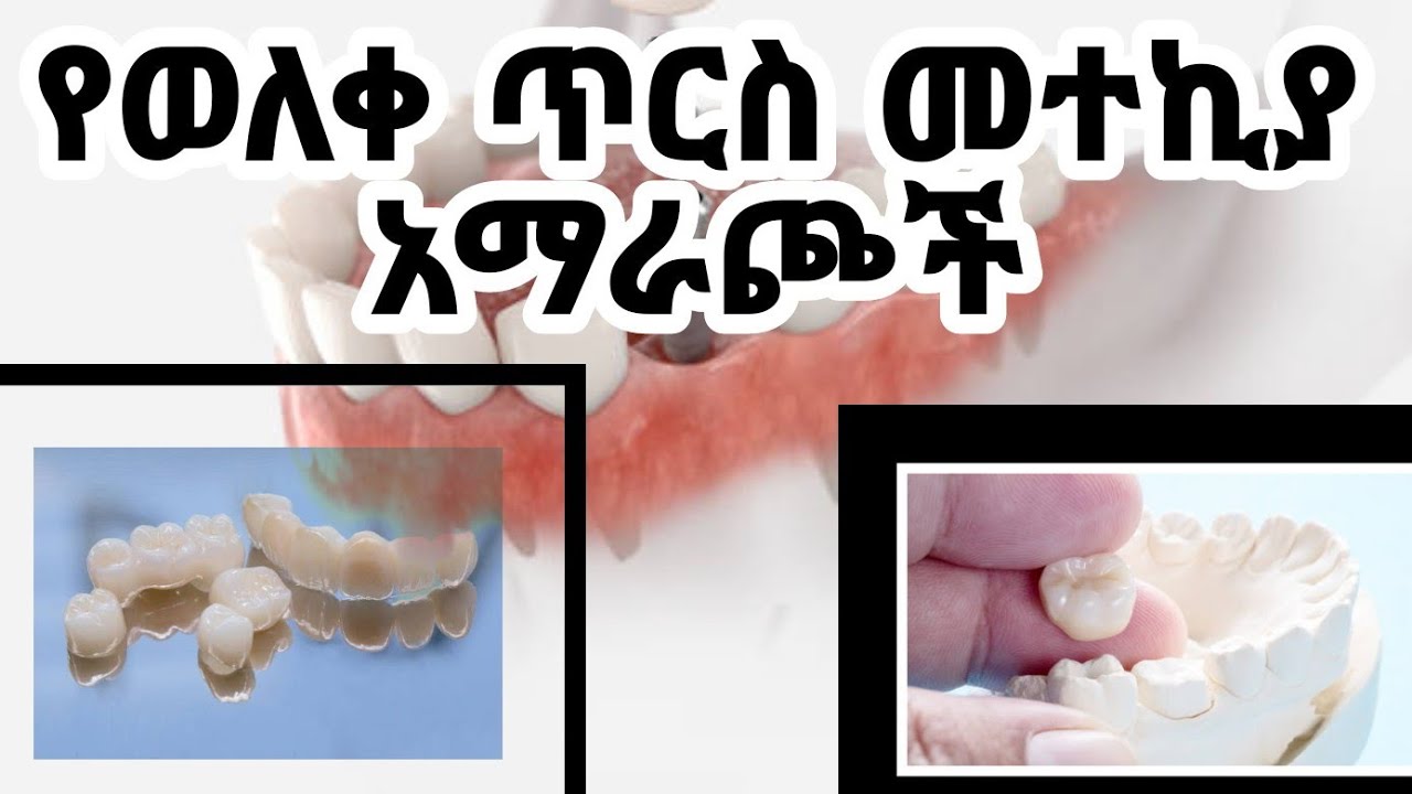3 ጥርስ ለጎደለባቸው /ለተነቀለባቸው መተኪያ አማራጮች/@ዶርሚሊዮንDrMillion