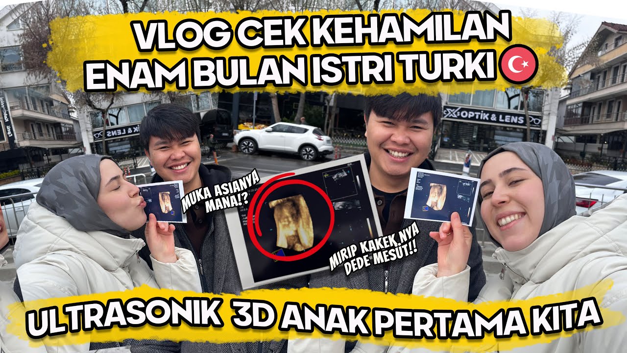 ALHAMDULILLAH CECK KANDUNGAN ISTRI TURKI🇹🇷 YANG KE ENAM BULAN PAKAI 3D ULTRASONIK I MIRIP KAKEKNYA😆