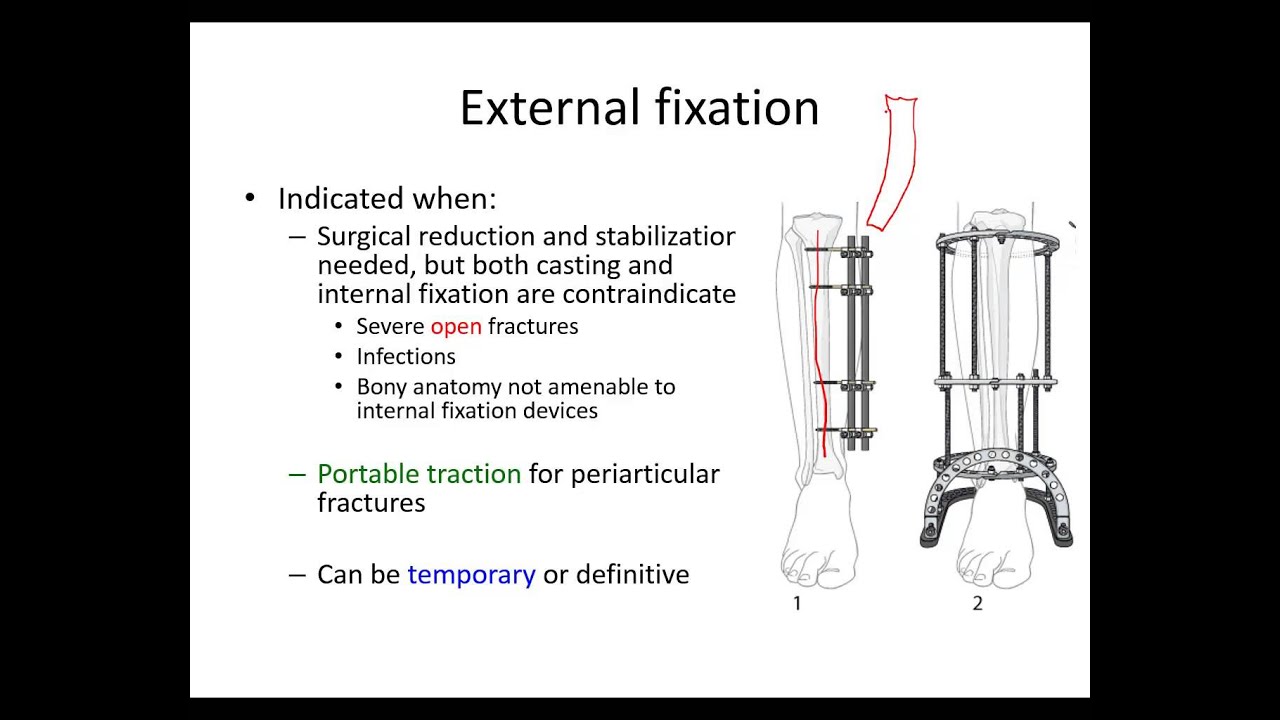 Orthopaedic trauma for med students 2