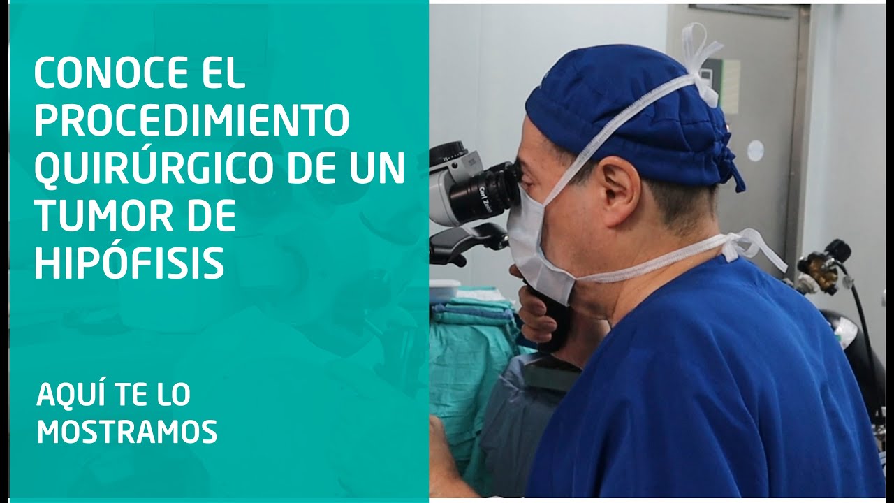 Cirugía de tumor de hipófisis