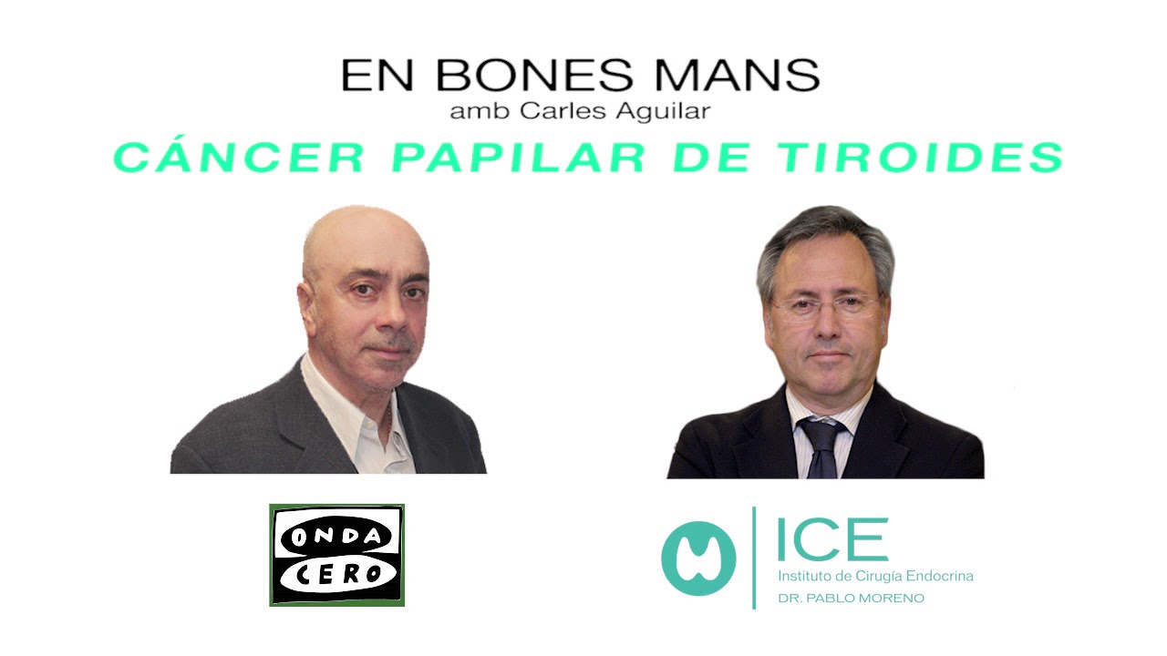 Cáncer papilar de tiroides _ EN BONES MANS