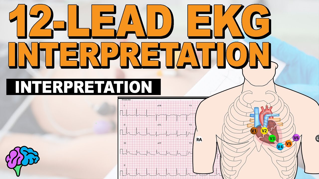 The SIMPLE Steps of 12-Lead EKG Interpretation - EXPLAINED CLEARLY!