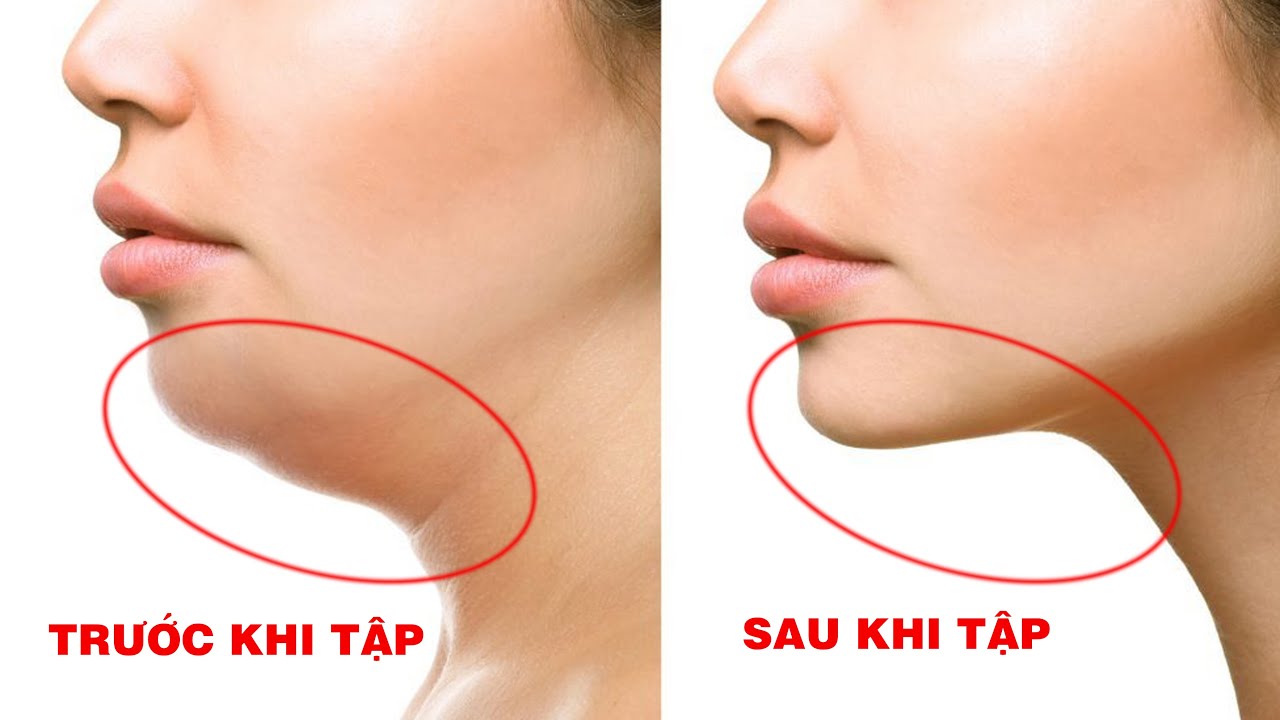 7 Bài Tập Giúp Giảm Nọng Cằm, Mặt Thon Gọn Hiệu Quả 100%
