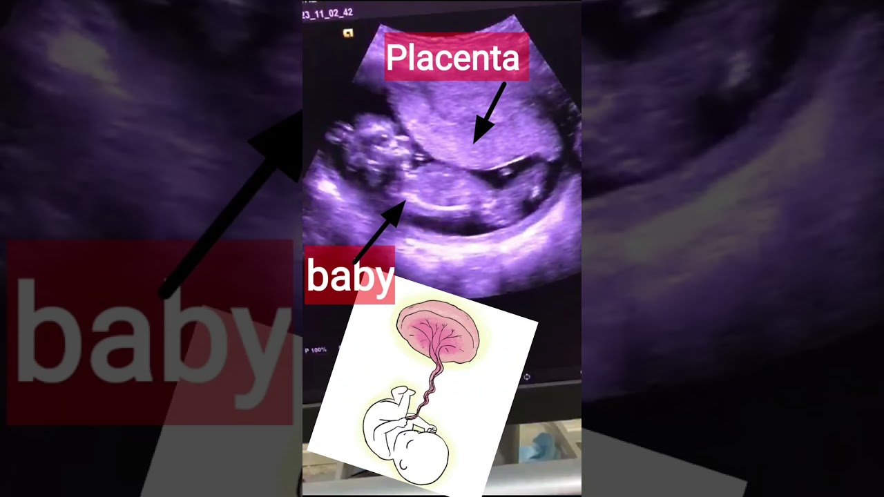 Placenta in pregnancy/ what's Placenta/ shortvideo