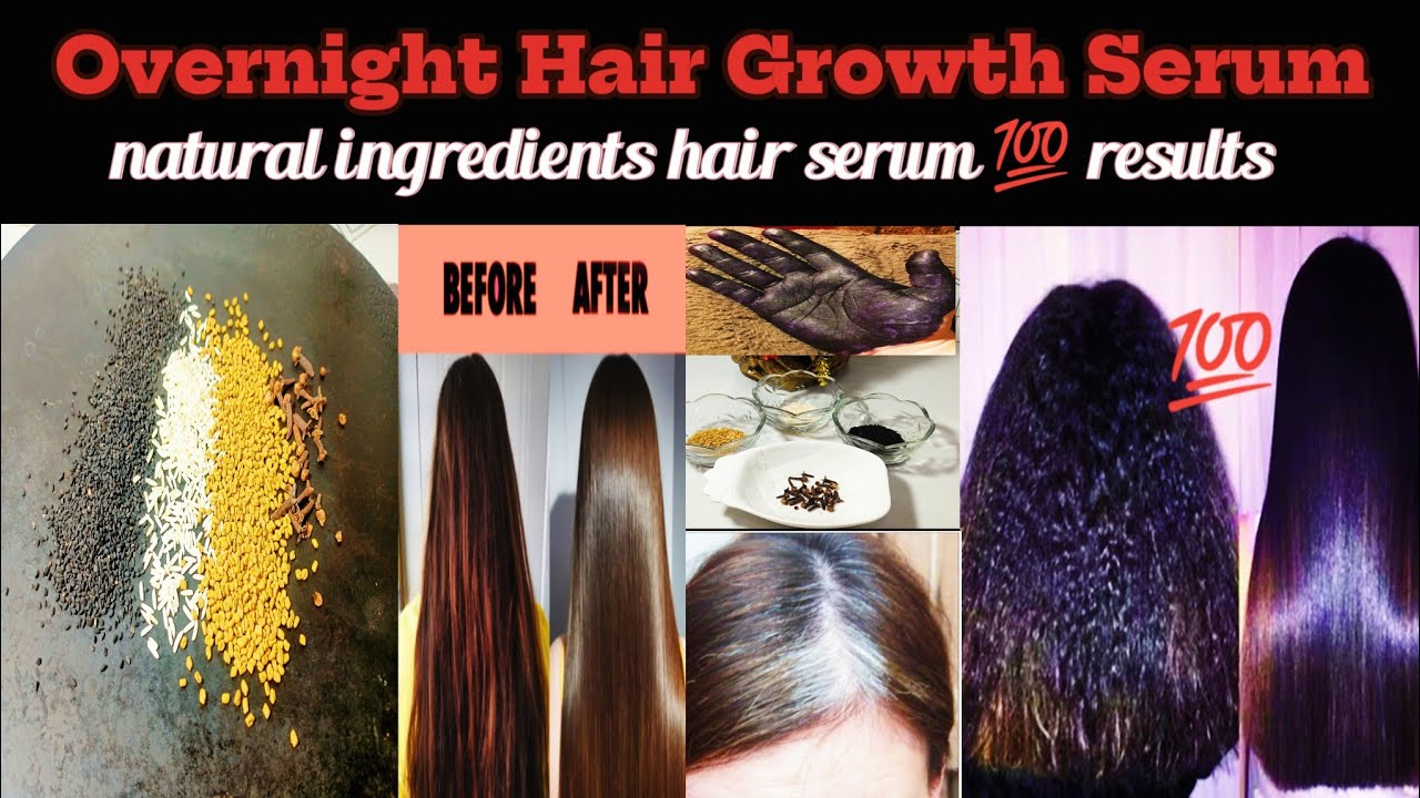 Hair regrowth serum remedy by Billokadhaaba ||extreme hair growth challenge with natural ingredients