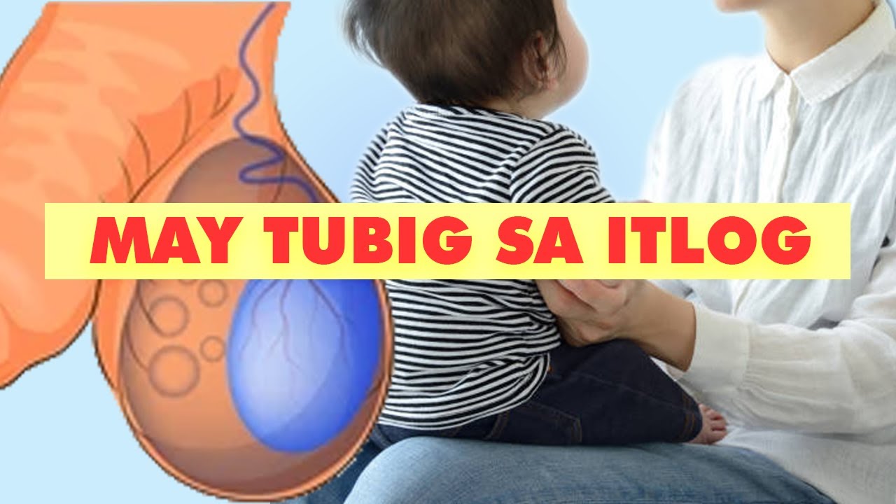 [Q&A] LUSLOS (HERNIA), TUBIG SA ITLOG (HYDROCELE) AT SPIRULINA