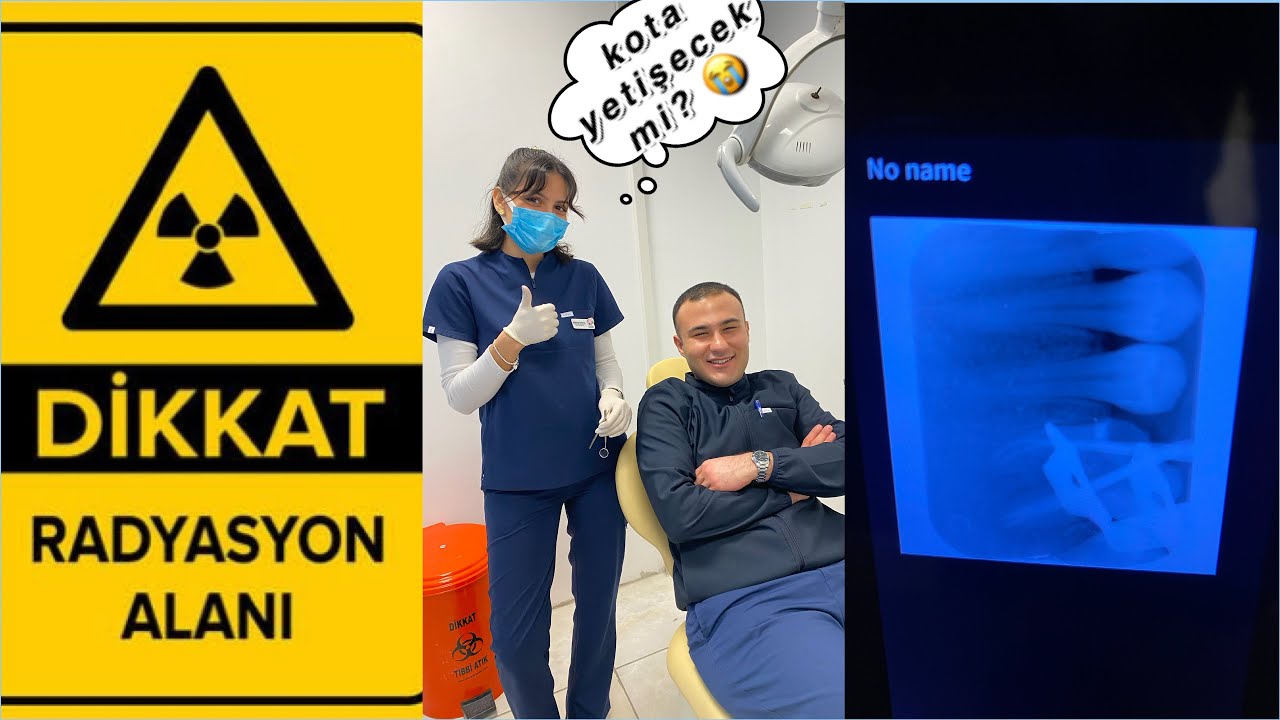 oral diagnoz stajım ☢️