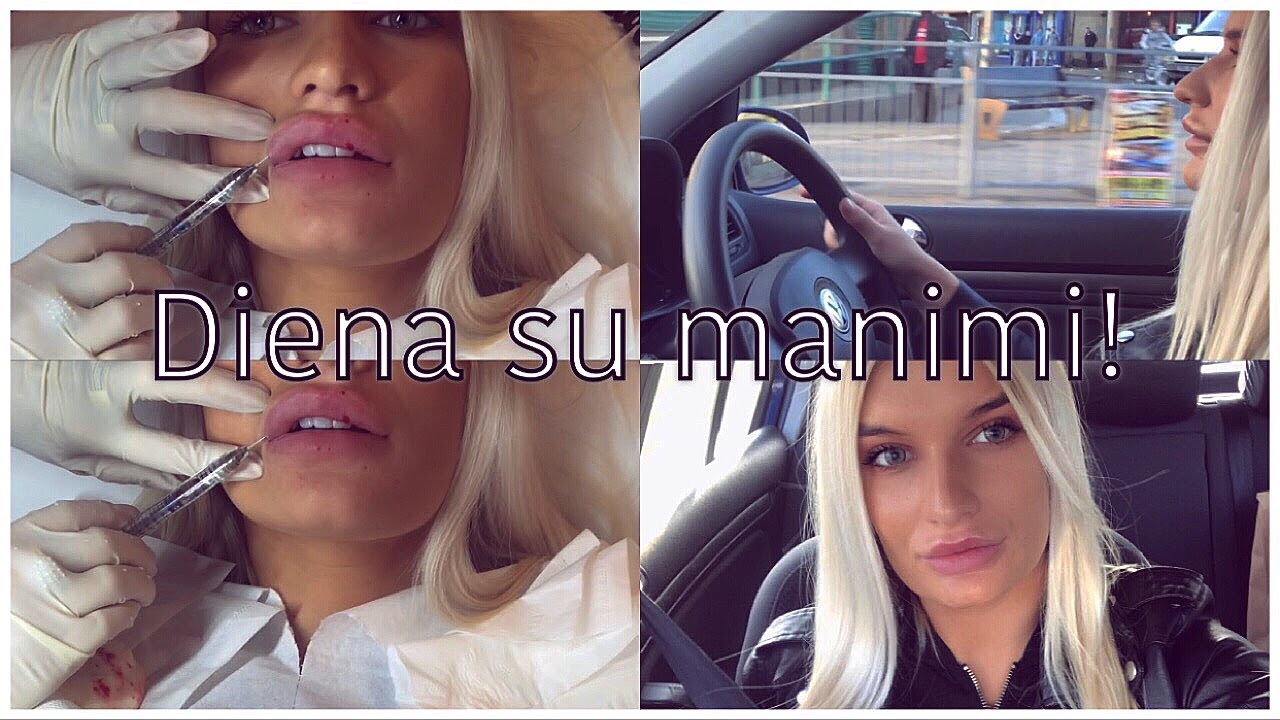 Diena su manimi! (lūpų injekcijos, kirpykla ir t.t.. ) 😅