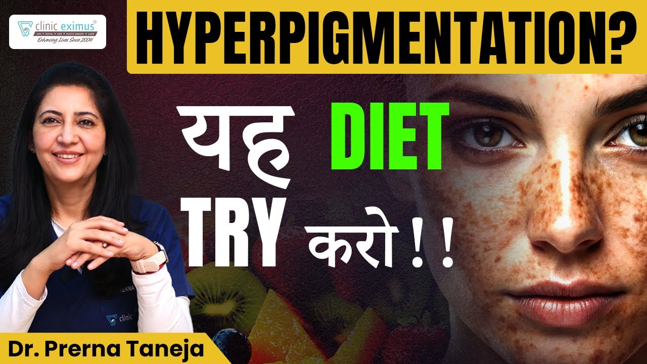 Diet for Hyperpigmentation | Clear Skin Secrets | Clinic Eximus