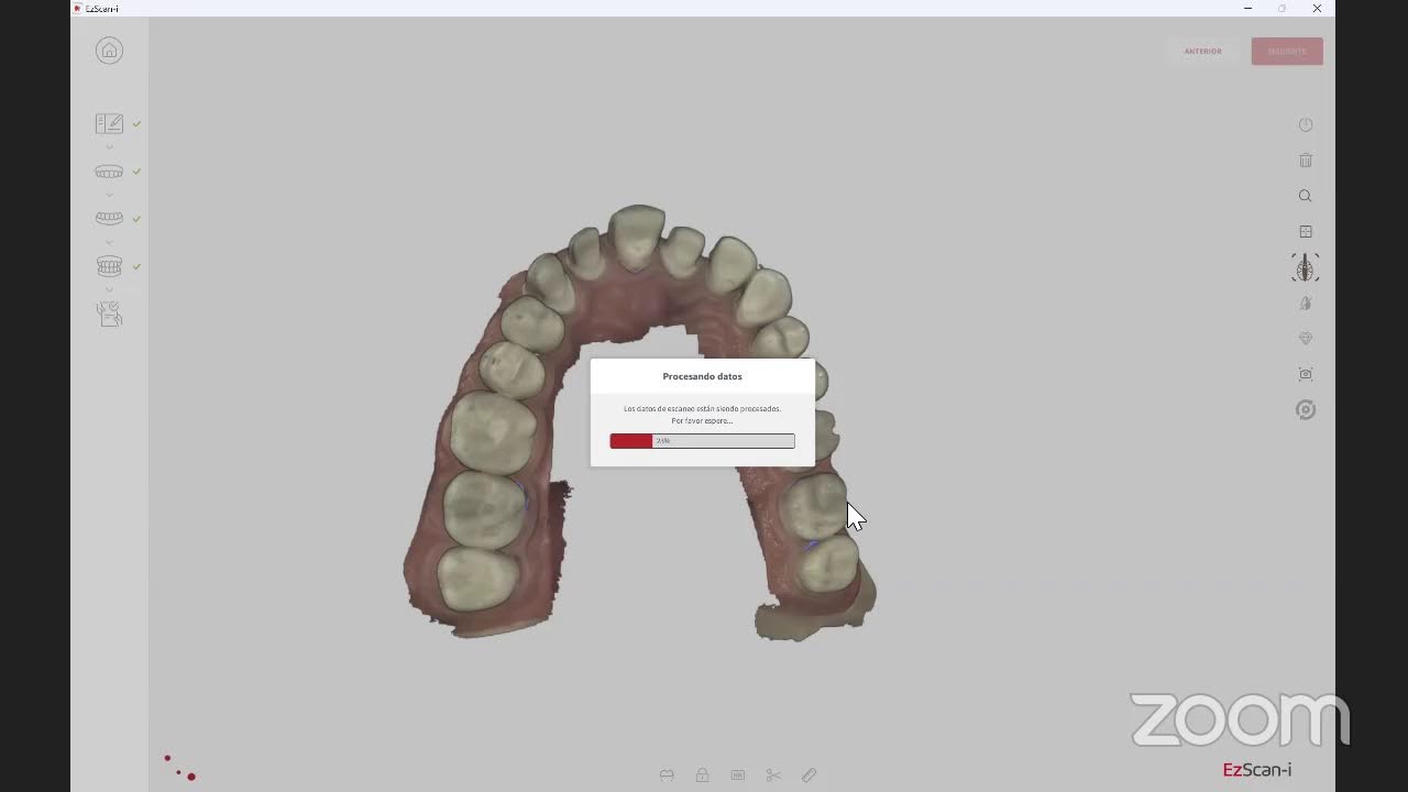 Ventajas del EzScan en el flujo digital en odontología