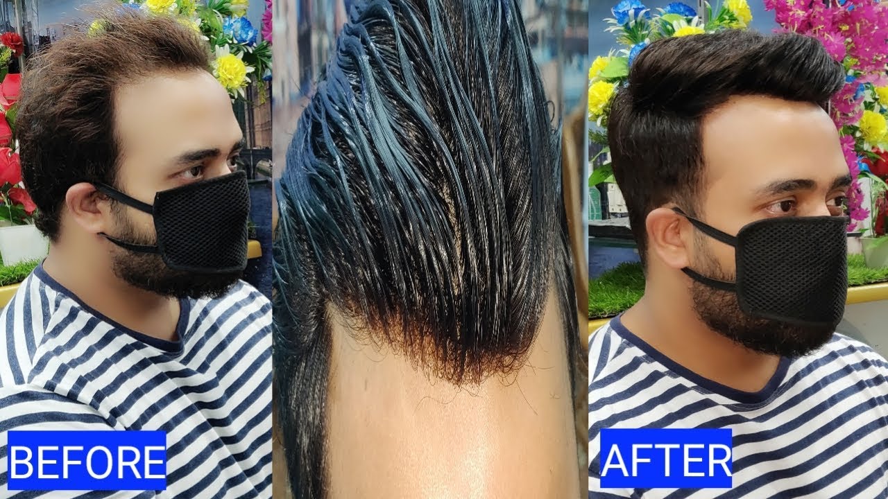 Front less natural hair line, hair patch system by anas sheikh, call📲 9650914665 for more info whts