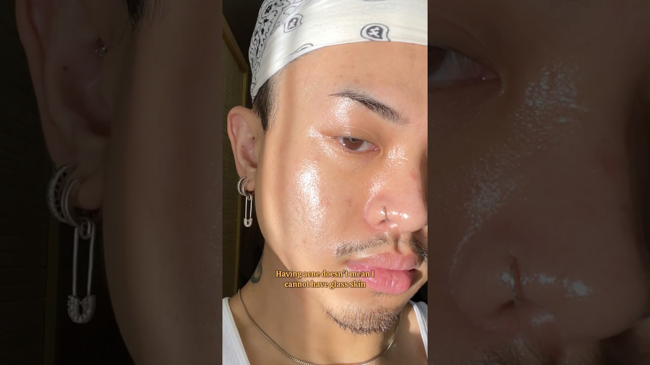 Acne-prone skin can also have ✨ GLASS SKIN ✨ BRINGGREEN