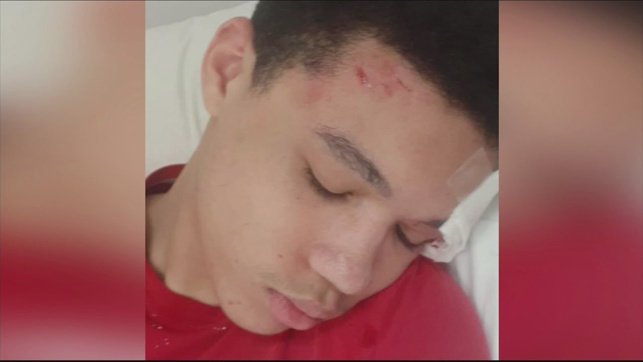 Teenagers attacked during Davenport protest