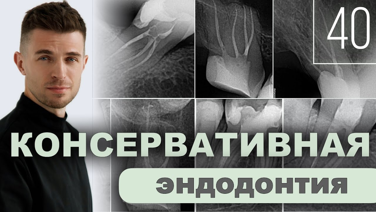 Консервативная эндодонтия. Уроки эндодонтии. Выпуск 40