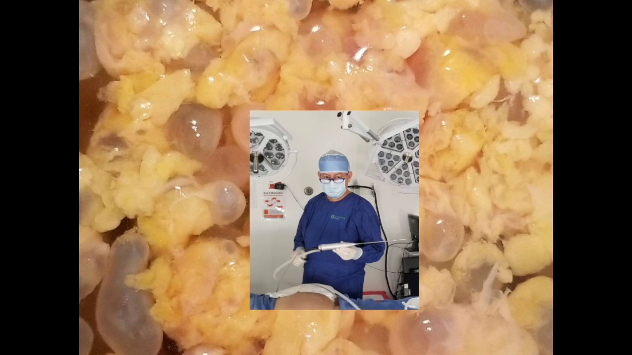 Biopolímeros: ¿Qué son y cómo se forman?