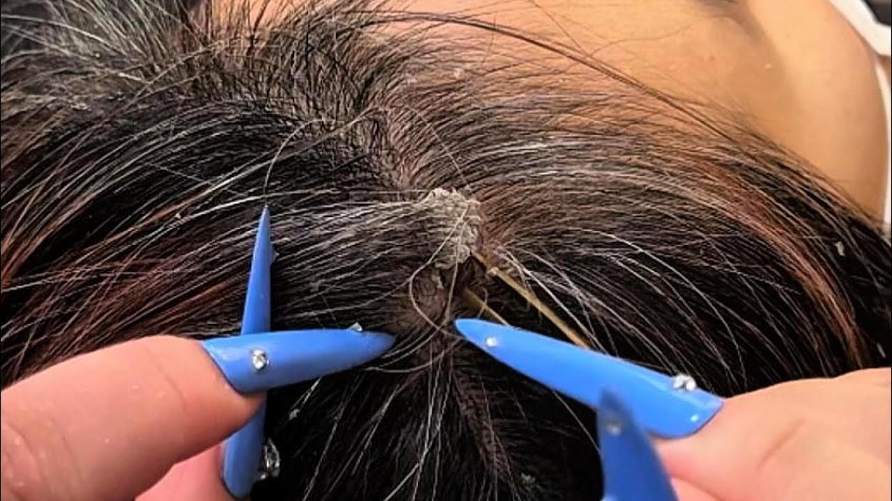 Soothing Scalp ASMR with Latte — Calm Four-Finger Flow & Quiet Tweezer Details