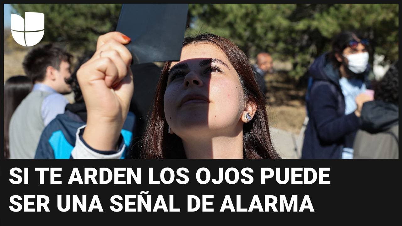 ¿Te arden los ojos tras ver el eclipse solar sin lentes? Una te explica qué debes hacer