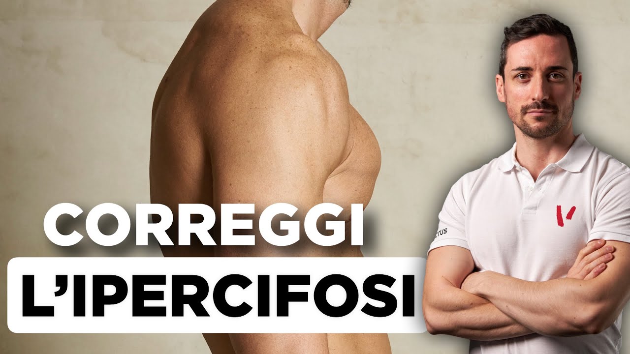 Come correggere l'ipercifosi