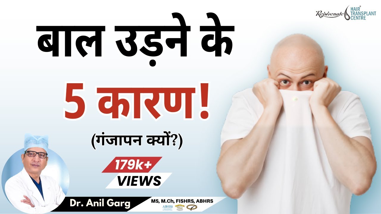 बाल उड़ने के 5 कारण! | गंजापन क्यों? | 5 Main Cause of Baldness in Men | Stop Going Bald