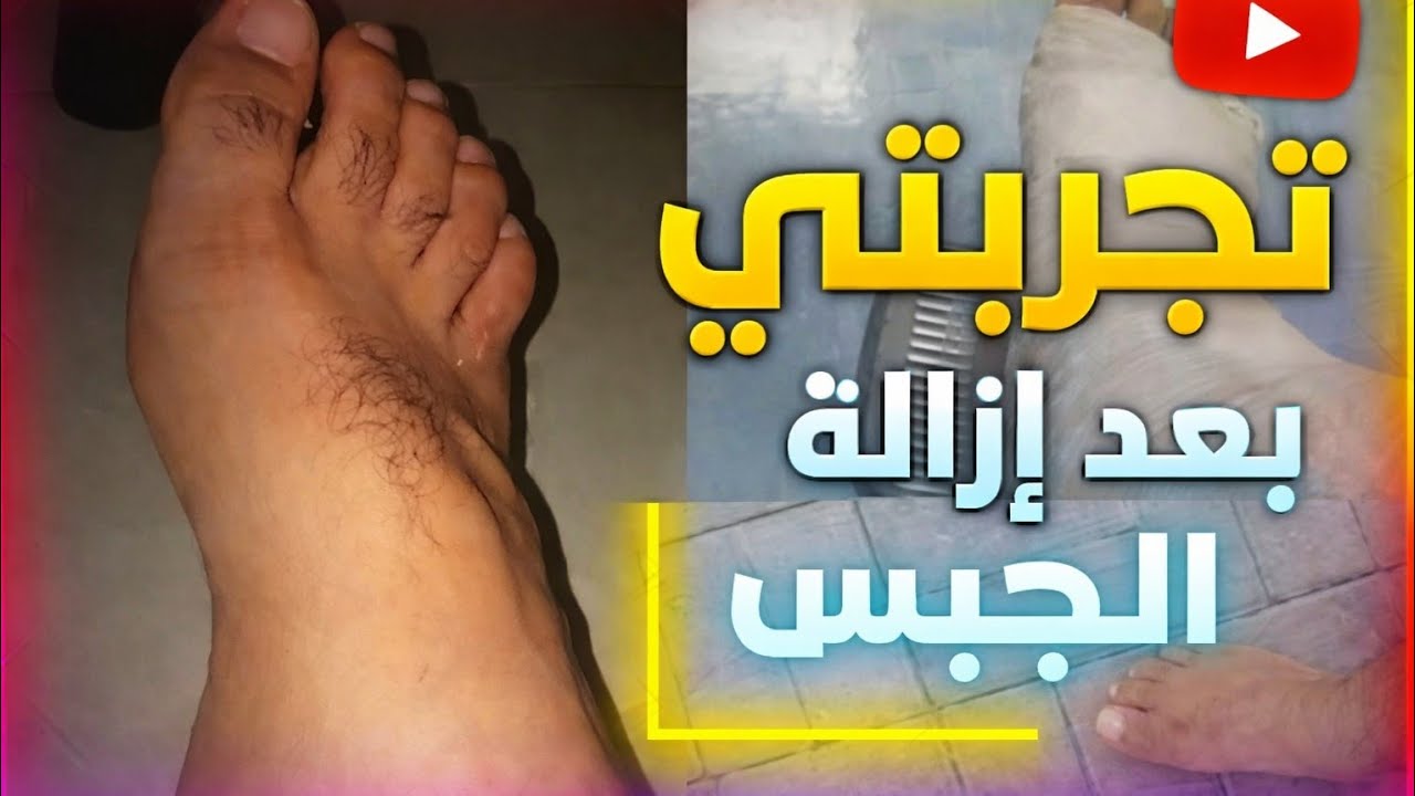 تجربتي|ما بعد ازالة الجبس|خطواتي للعناية بالقدم بعد إزالة الجبس 2022