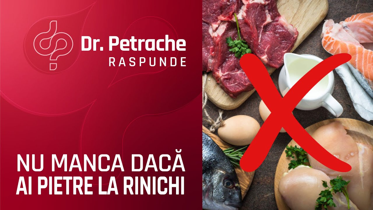 CE SA NU MANANCI DACA AI PIETRE LA RINICHI?