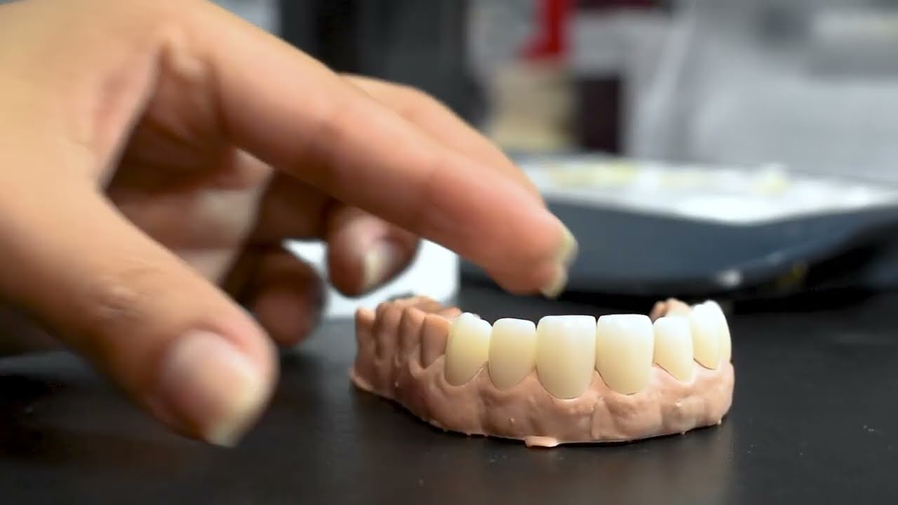 Proceso de CAD CAM en Laboratorio Dental Digital