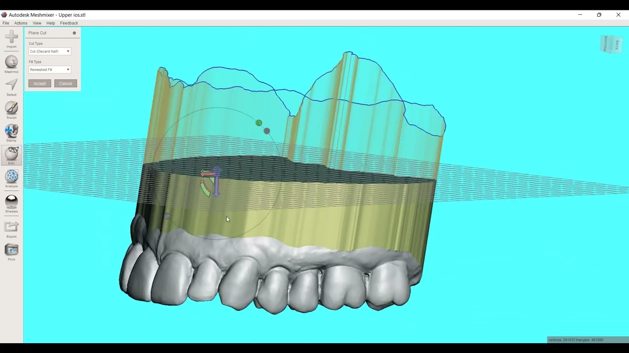 Preparing an Intraoral Scan for 3d Printing