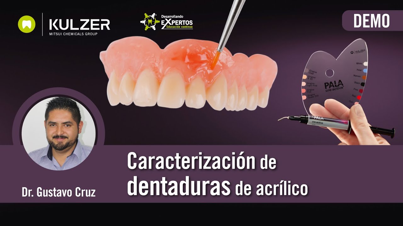 Caracterización de dentaduras de acrílico