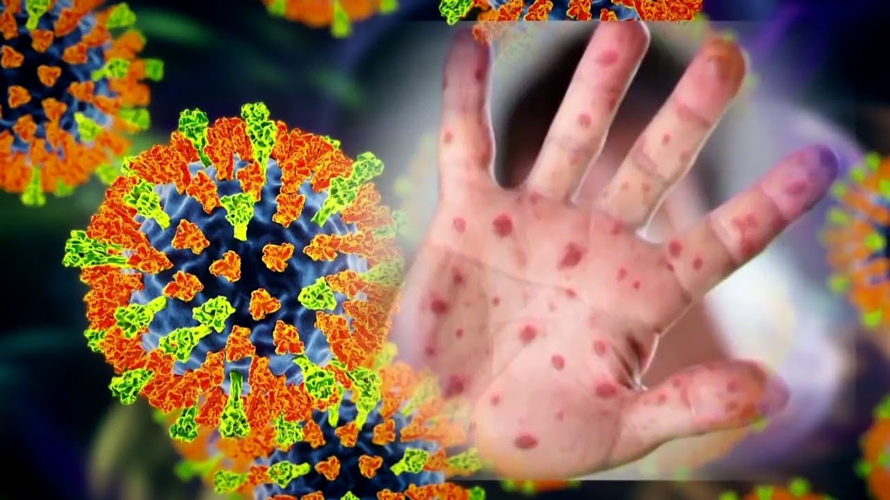 В Великобританию возвращаются болезни викторианской эпохи 🦠