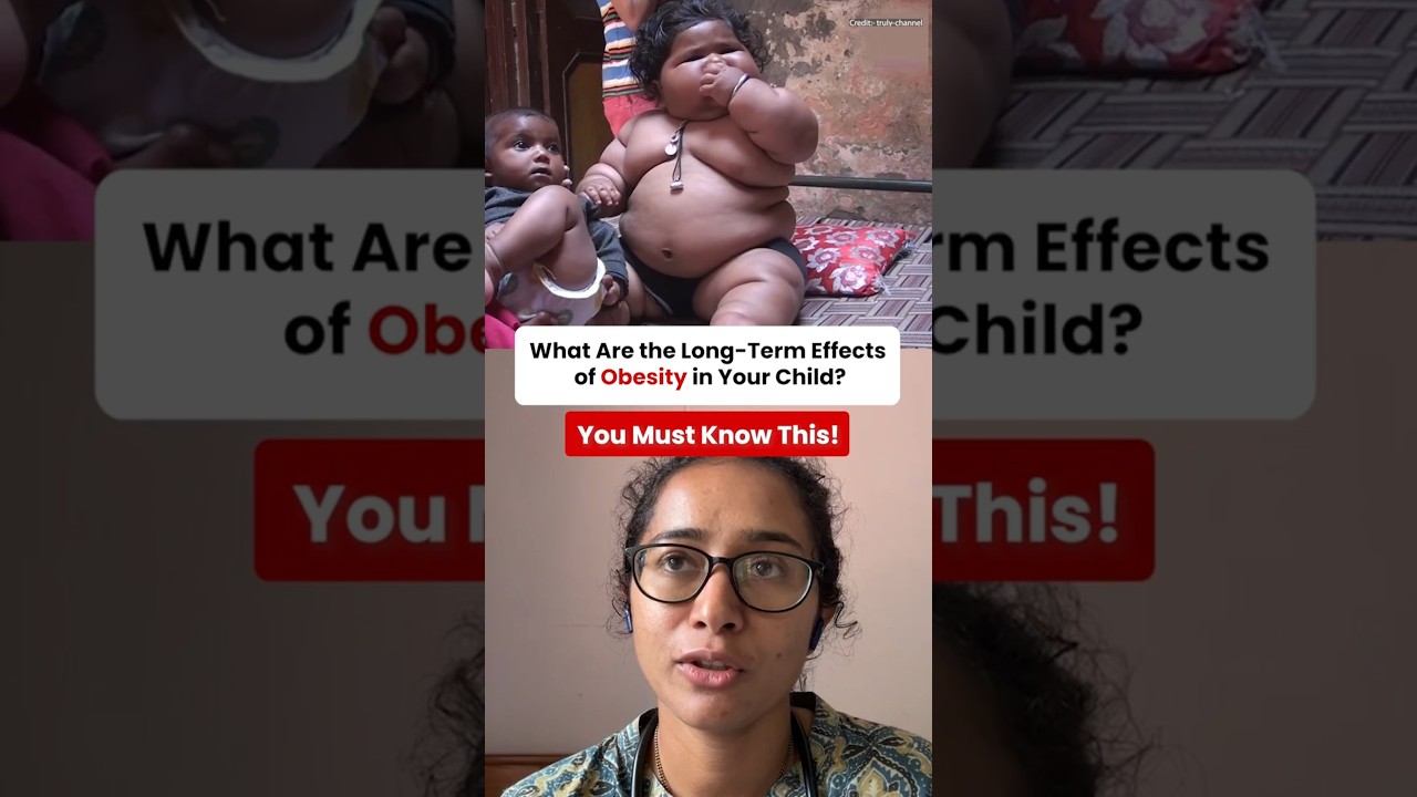 Long-Term Effects of Childhood Obesity Every Parent Must Know