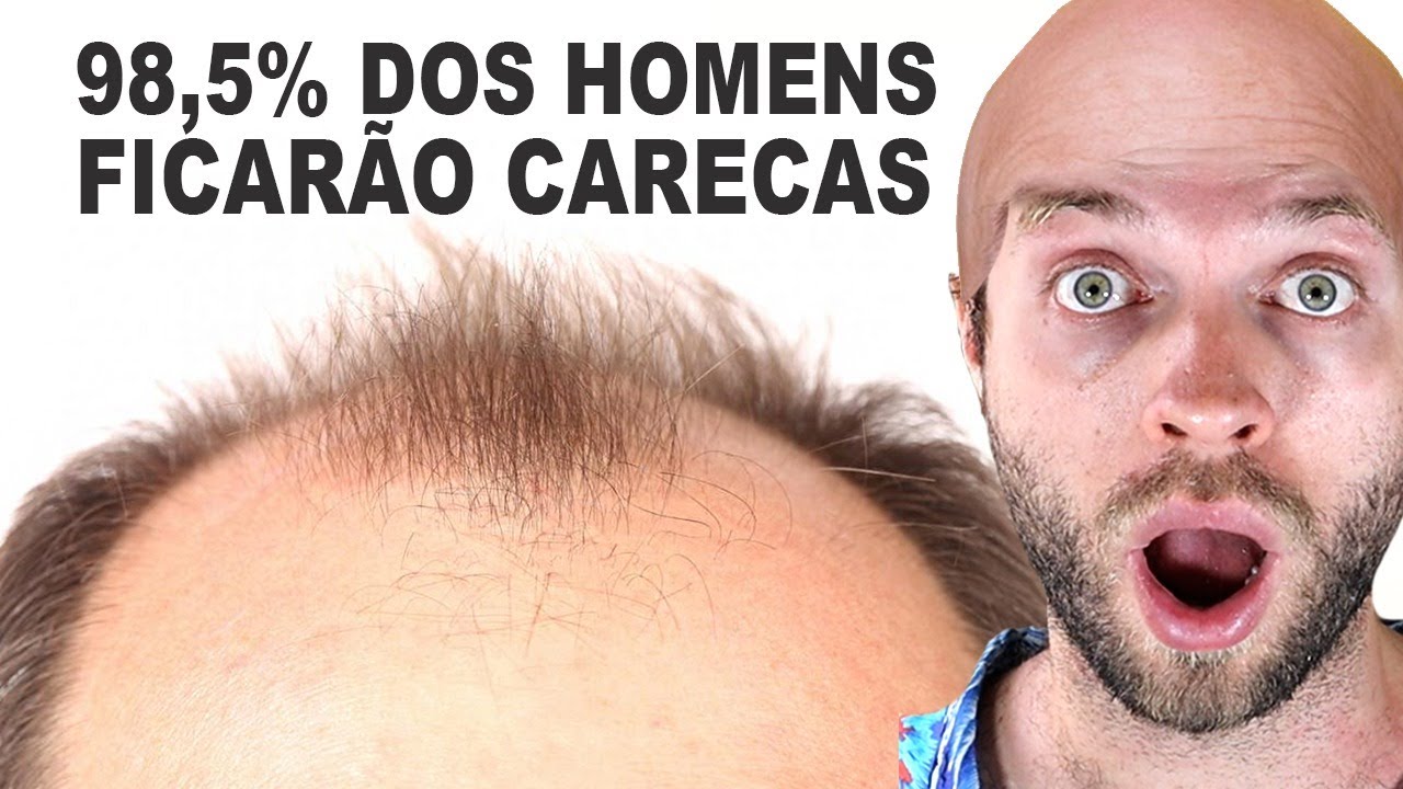 POR QUE FICAMOS CALVOS | SEGREDO REVELADO