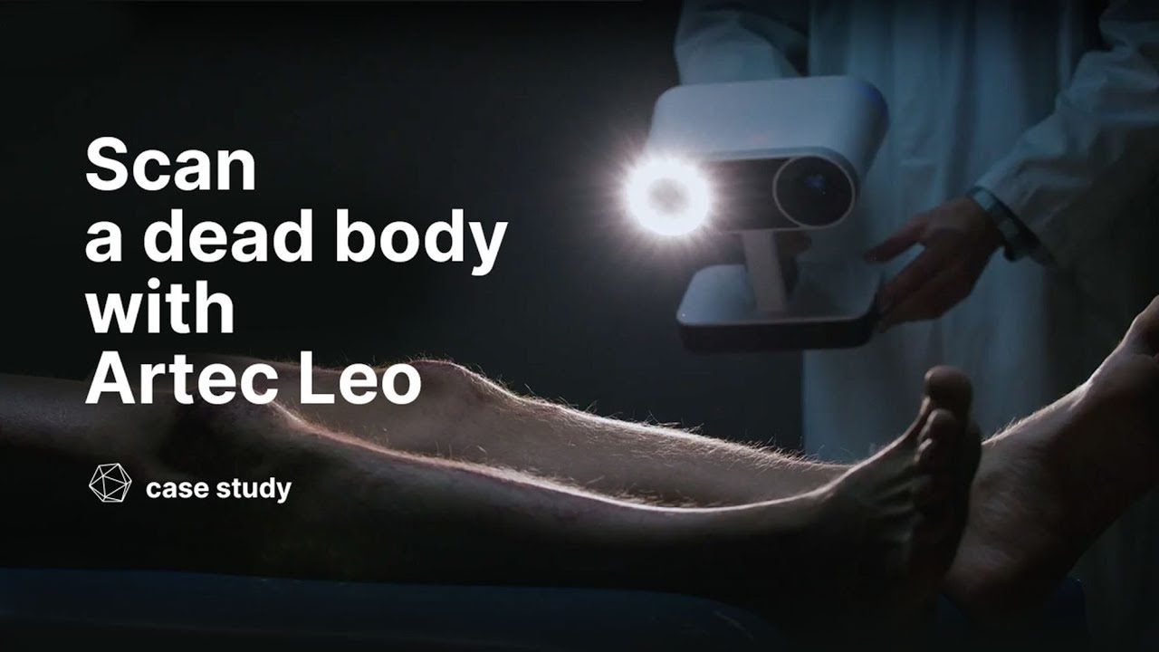 3D scanning a dead body with Artec Leo