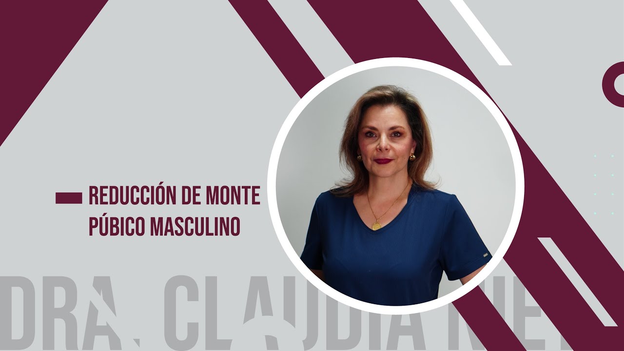 REDUCCIÓN DE MONTE PÚBICO MASCULINO - DRA. CLAUDIA NIETO
