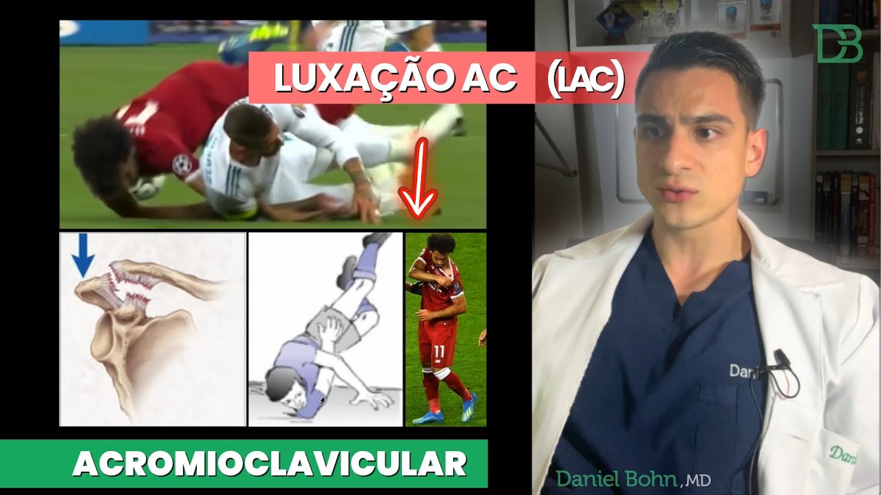 LUXAÇÃO ACROMIOCLAVICULAR (LAC) #ANATOMIA | Daniel Bohn