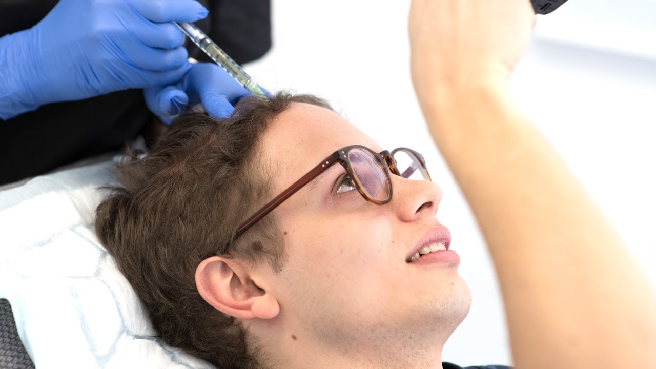 PRP-behandling på Daniel Redgert | Nordic Hair®