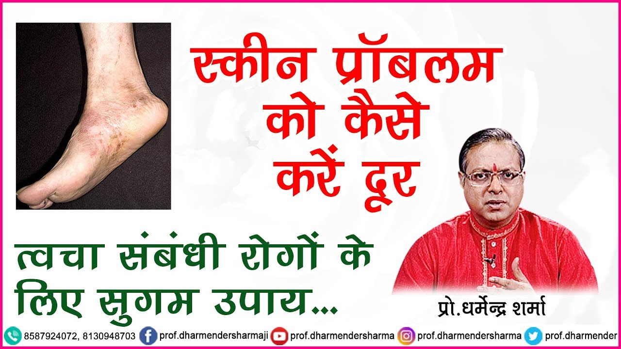 Skin Problems को कैसे करें दूर - जानें प्रो.धर्मेन्द्र शर्मा जी से