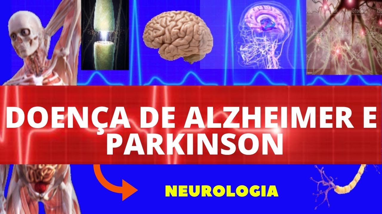 DOEN&Ccedil;A DE ALZHEIMER E PARKINSON - (CAUSAS, SINTOMAS, DIAGN&Oacute;STICO E TRATAMENTO) - NEUROLOGIA