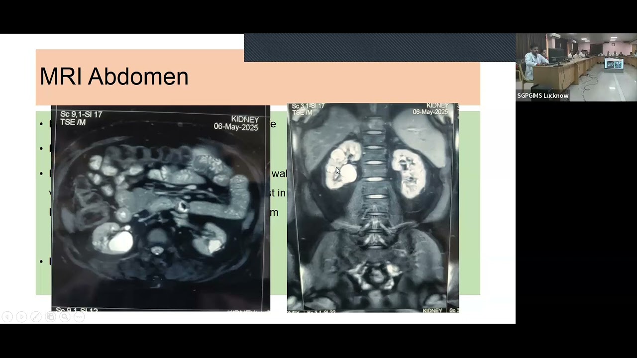 SGPGI and CMC Vellore Endocrinology Meet, 17 Oct 2025