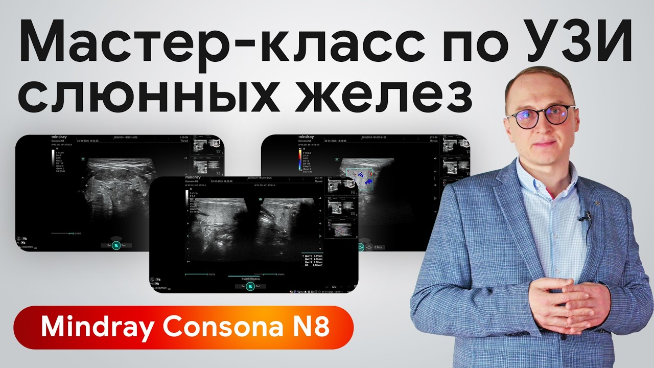 УЗИ слюнных желез: практический мастер-класс на Mindray Consona N8