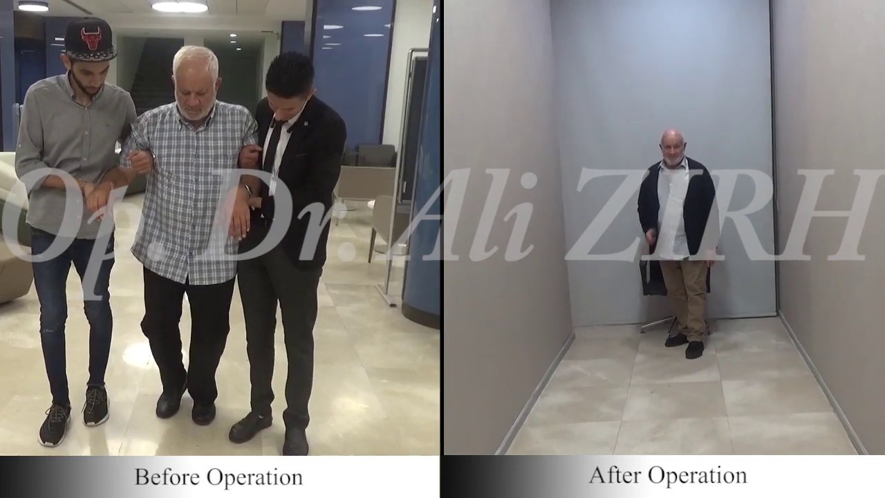 Mohamed SAADI / Before and After Surgery Parkinson's Treatment DBS in Turkey