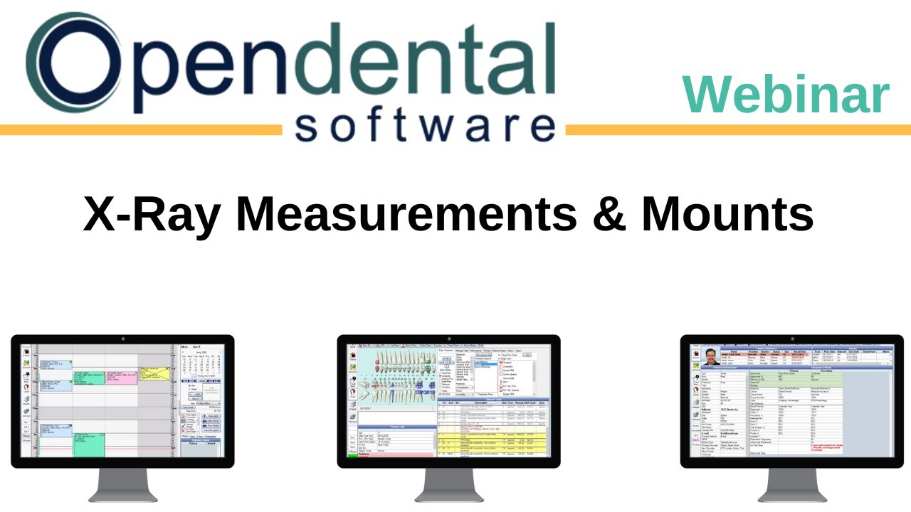 Open Dental Webinar - X-Ray Measurements and Mounts
