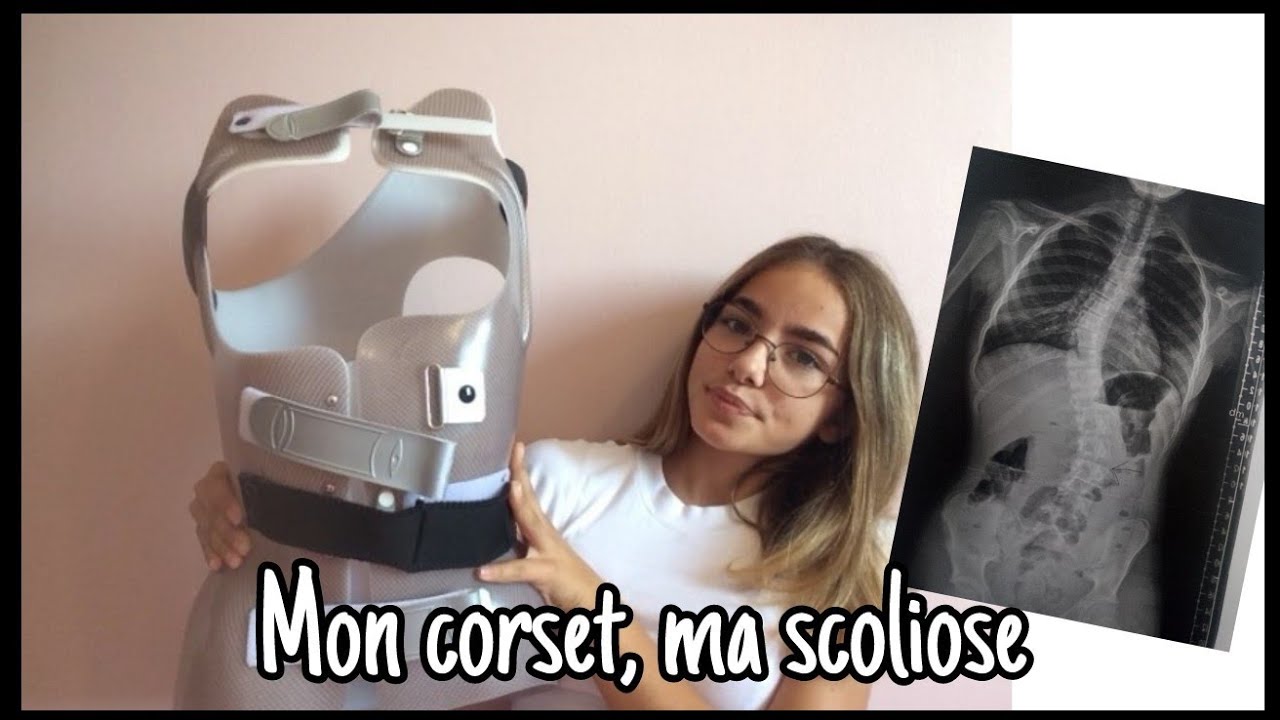 Mon corset, ma scoliose 🍀