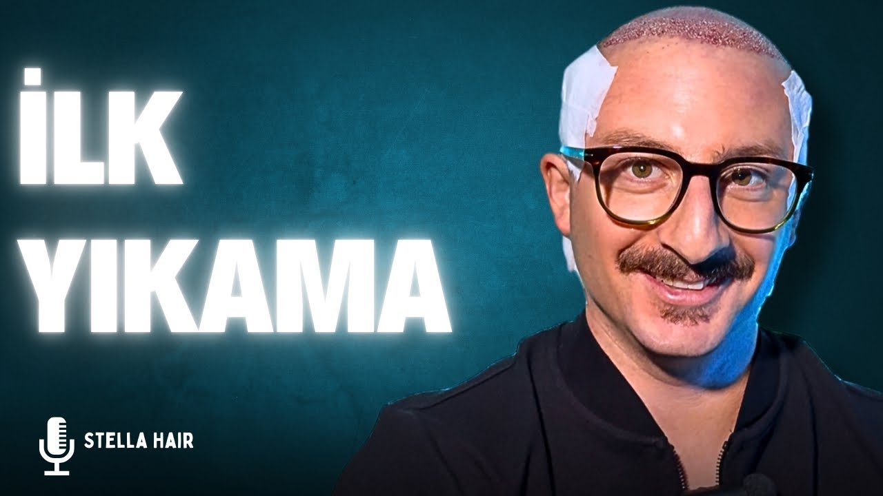 Saç Ekimi İşlem İLK YIKAMA Nasıl Yapılır ? | İstanbul Stella Hair | #sacekimi #saçekimiistanbul